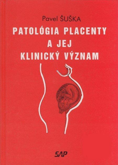 Kniha: Patológia placenty a jej klinický význam - Pavel Šuška