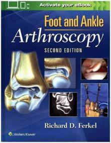 Foot - Ankle Arthroscopy, 2nd Ed.