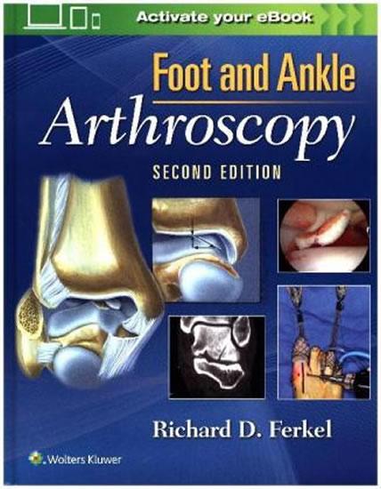 Kniha: Foot - Ankle Arthroscopy, 2nd Ed. - Ferkel Richard G.