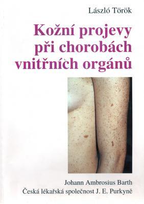 Kniha: Kožní projevy při chorobách vnitřních orgánů - Laszlo  Török