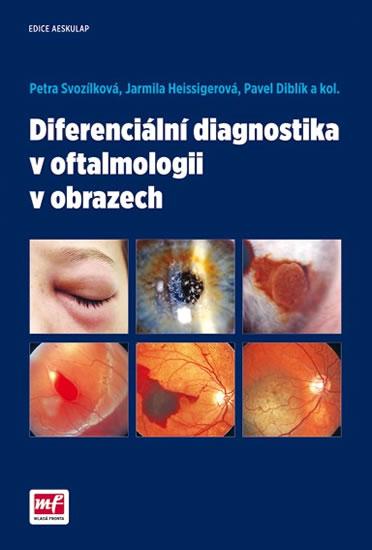 Kniha: Diferenciální diagnostika v oftalmologii v obrazech - Svozílková a kolektiv Petra