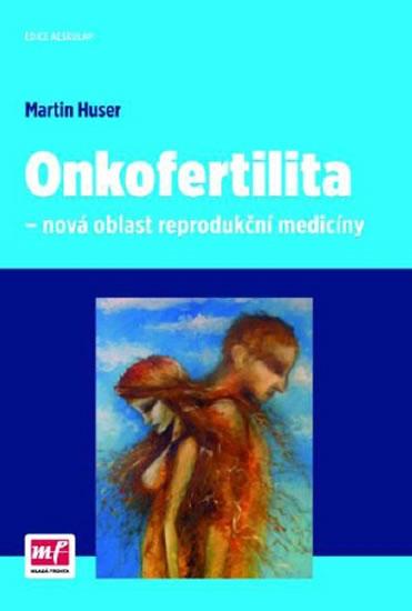 Kniha: Onkofertilita - nová oblast reprodukční medicíny - Huser Martin