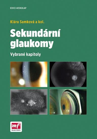 Sekundární glaukomy - Vybrané kapitoly