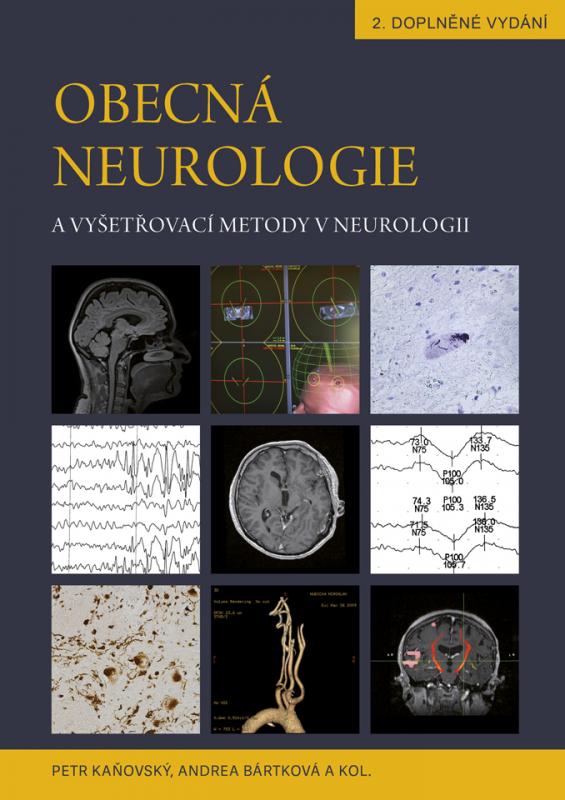 Kniha: Obecná neurologie a vyšetřovací metody v neurologii - Petr Kaňovský