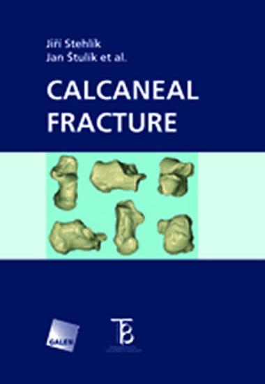 Kniha: Calcaneal Fracture - Stehlík Jiří