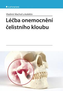 Kniha: Léčba onemocnění čelistního kloubu - Machoň Vladimír