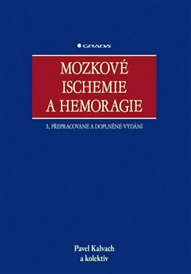 Kniha: Mozkové Ischemie a Hemoragie - Kolektív WHO