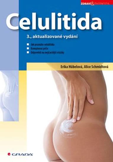 Kniha: Celulitida - 3. vydání - Schmidtová, Hübelová Erika, Alice