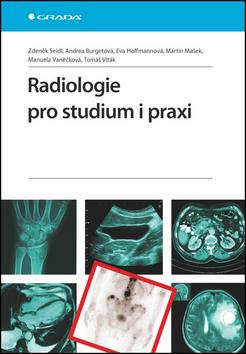 Kniha: Radiologie pro studium i praxi - Zdeněk Seidl; Andrea Burgetová; Eva Hoffmannová; Martin Mašek; Manuela Vaněčk...