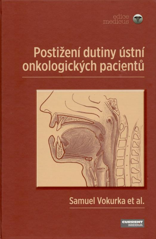 Kniha: Postižení dutiny ústní onkologických pacientů - Samuel Vokurka a kolektív