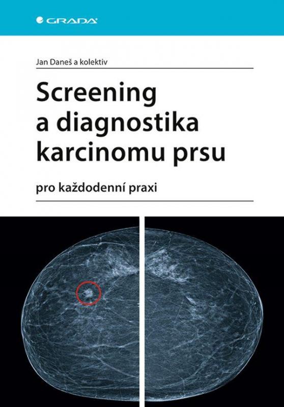 Kniha: Screening a diagnostika karcinomu prsu pro každodenní praxi - Daneš Jan