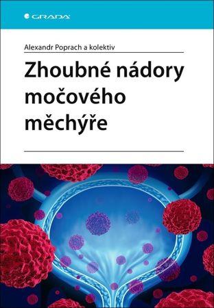 Kniha: Zhoubné nádory močového měchýře - Alexandr Poprach