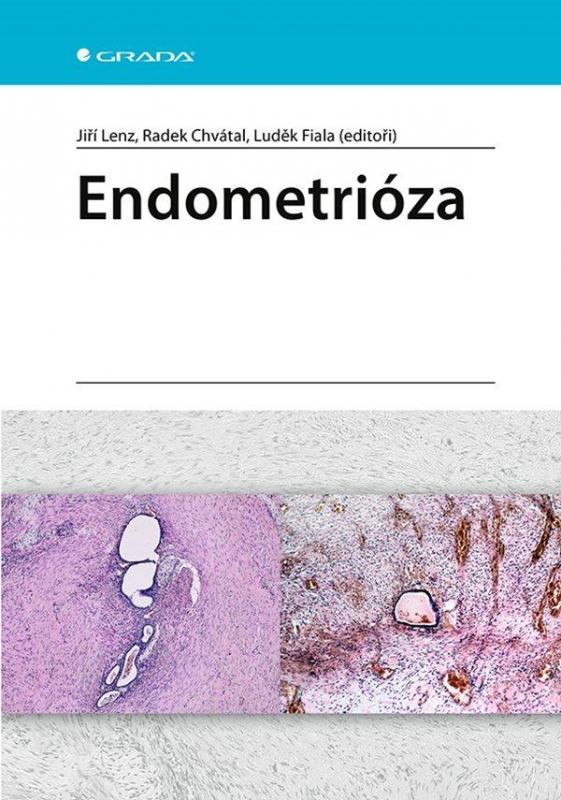 Kniha: Endometrióza - Lenz a kolektiv Jiří