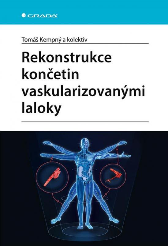 Kniha: Rekonstrukce končetin vaskularizovanými laloky - Kempný Tomáš