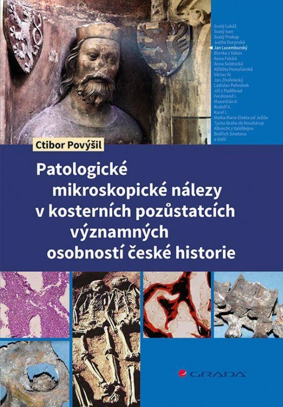 Kniha: Patologické mikroskopické nálezy v kosterních pozůstatcích významných osobností české historie - Povýšil a kolektiv Ctibor