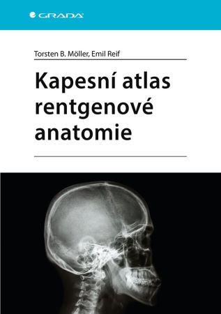 Kniha: Kapesní atlas rentgenové anatomie - Torsten B. Möller