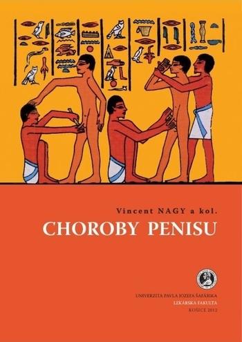 Kniha: Choroby penisu - Vincent Nagy