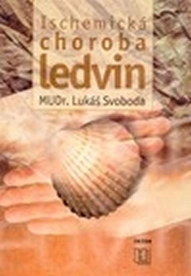 Kniha: Ischemická choroba ledvin - Svoboda Lukáš