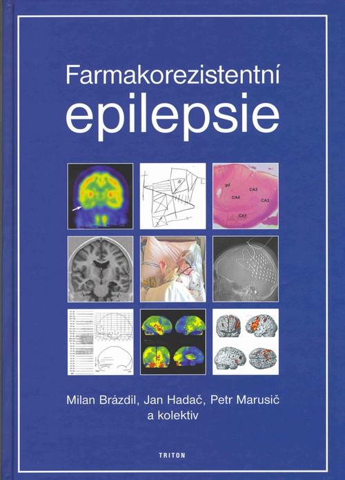 Kniha: Farmakorezistentní epilepsie - Milan Brázdil