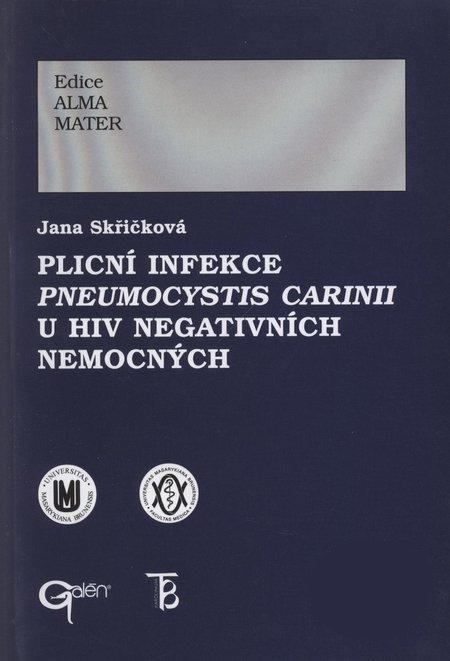 Kniha: Plicní infekce Pneumocystis carinii u HIV negativních nemocných - Jana Skřičková