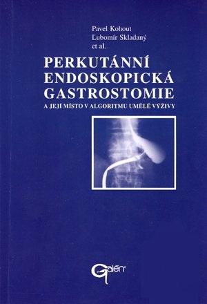 Kniha: Perkutánní endoskopická gastrostomie a její místo v algoritmu umělé výživy - Pavel Kohout