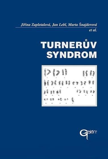 Kniha: Turnerův syndrom - Jiřina Zapletalová