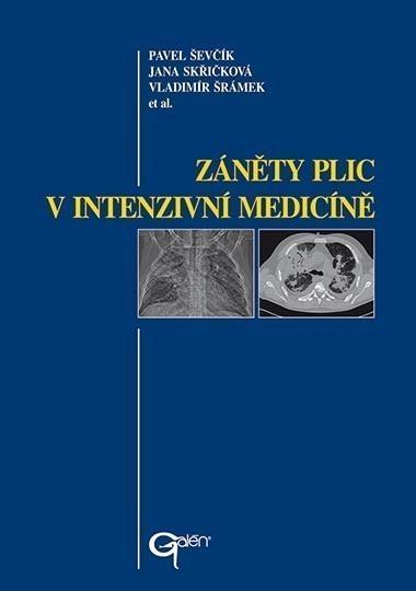 Kniha: Záněty plic v intenzivní medicíně - Pavel Ševčík