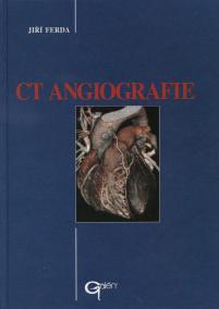 CT Angiografie