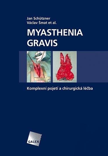 Kniha: Myasthenia gravis - Jan Schützner