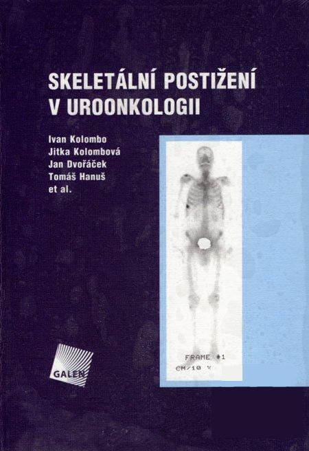 Kniha: Skeletální postižení v uroonkologii - Ivan Kolombo