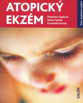 Kniha: Atopický ekzém - Štěpánka Čapková