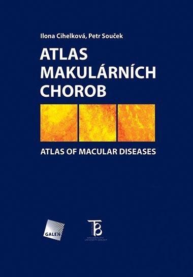 Kniha: Atlas makulárních chorob - Ilona Cihelková