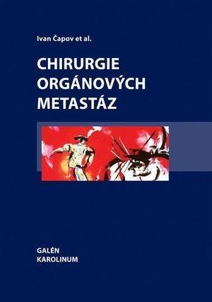 Kniha: Chirurgie orgánových metastáz - Ivan Čapov et al.