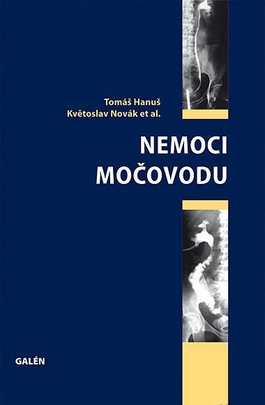 Kniha: Nemoci močovodu - Tomáš Hanuš