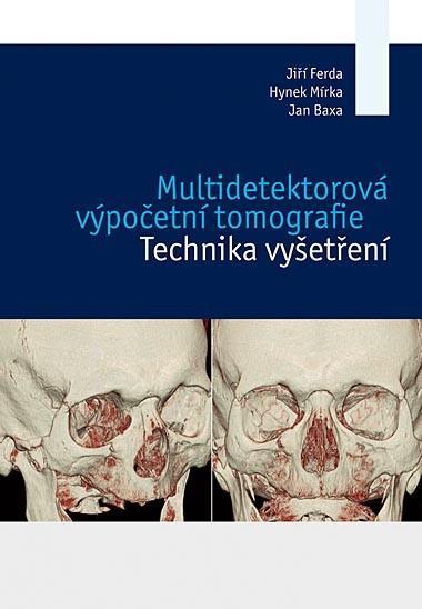 Kniha: Multidetektorová výpočetní tomografie - Jiří Ferda