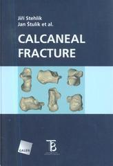 Calcaneal fracture