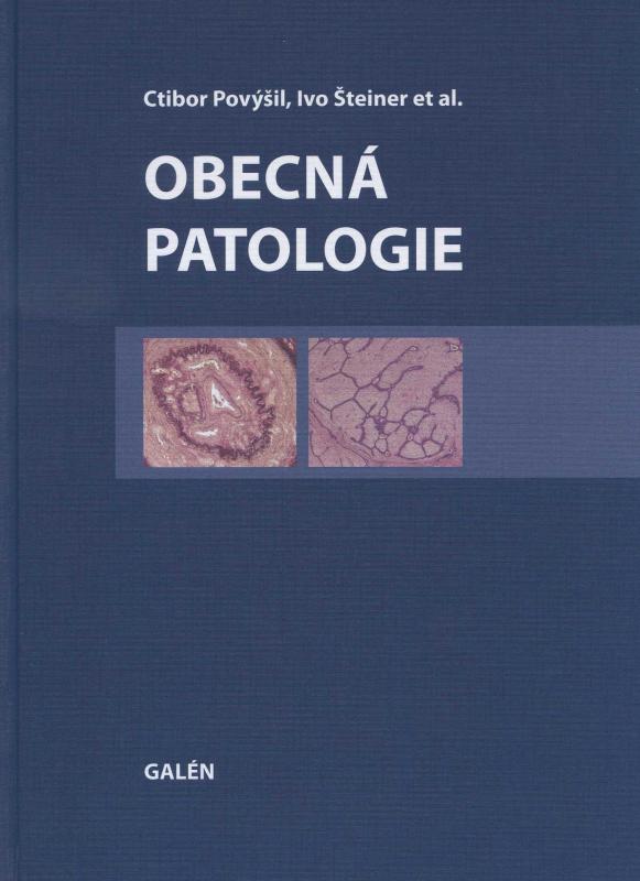 Kniha: Obecná patologie - Ctibor Povýšil