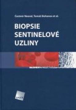 Kniha: Biopsie sentinelové uzliny - Čestmír Neoral