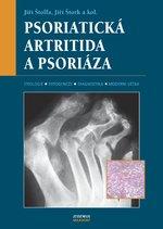 Kniha: Psoriatická artritida a psoriáza - Jiří Štolfa