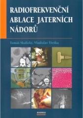 Kniha: Radiofrekvenční ablace jaterních nádorů - Tomáš Skalický