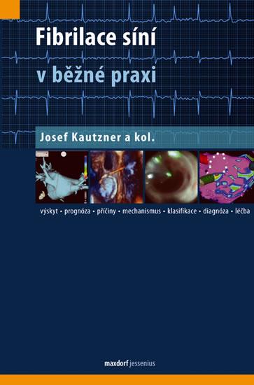 Kniha: Fibrilace síní v běžné praxi - Kautzner a kolektiv Josef