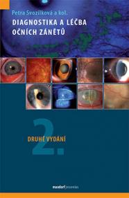 Diagnostika a léčba očních zánětů - 2.vydání