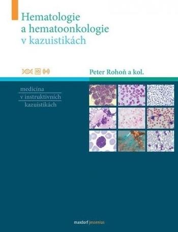 Kniha: Hematologie a hematoonkologie v kazuistikách - Peter Rohoň a kolektiv