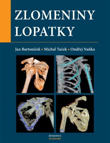 Kniha: Zlomeniny lopatky - Ondřej Naňka