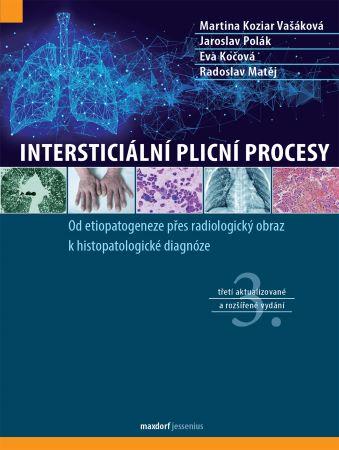 Kniha: Intersticiální plicní procesy (3. aktualizované a rozšířené vydání ) - Jaroslav Polák