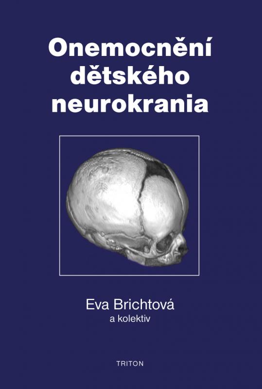 Kniha: Onemocnění dětského neurokrania - Eva Brichtová