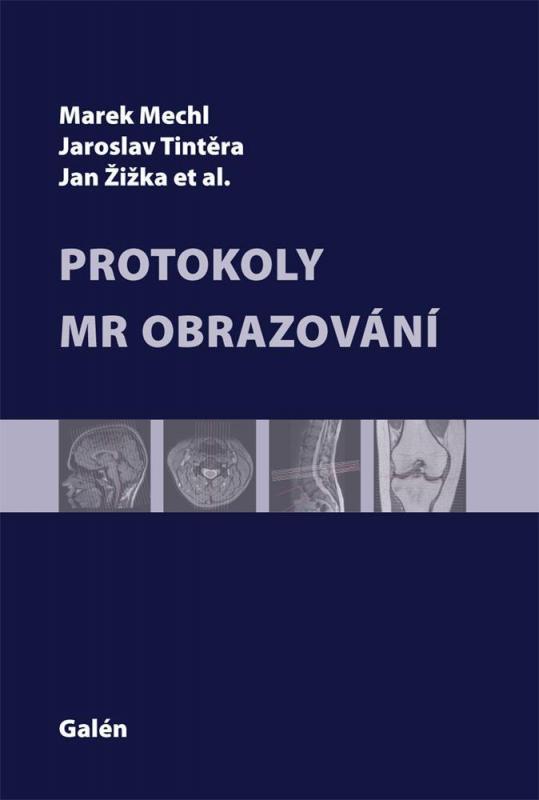 Kniha: Protokoly MR Zobrazování - Marek Mechl