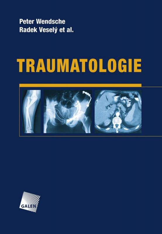 Kniha: Traumatologie - Peter Wendsche