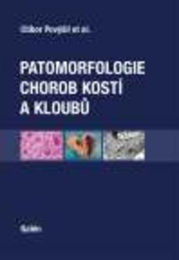 Kniha: Patomorfologie chorob kostí a kloubů - Ctibor Povýšil