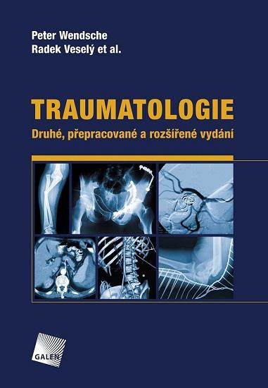 Kniha: Traumatologie (Druhé, přepracované a rozšířené vydání) - Peter Wendsche